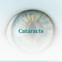 Cataracts