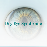 Dry Eye Syndrome