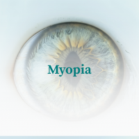 Myopia