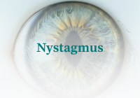 Nystagmus